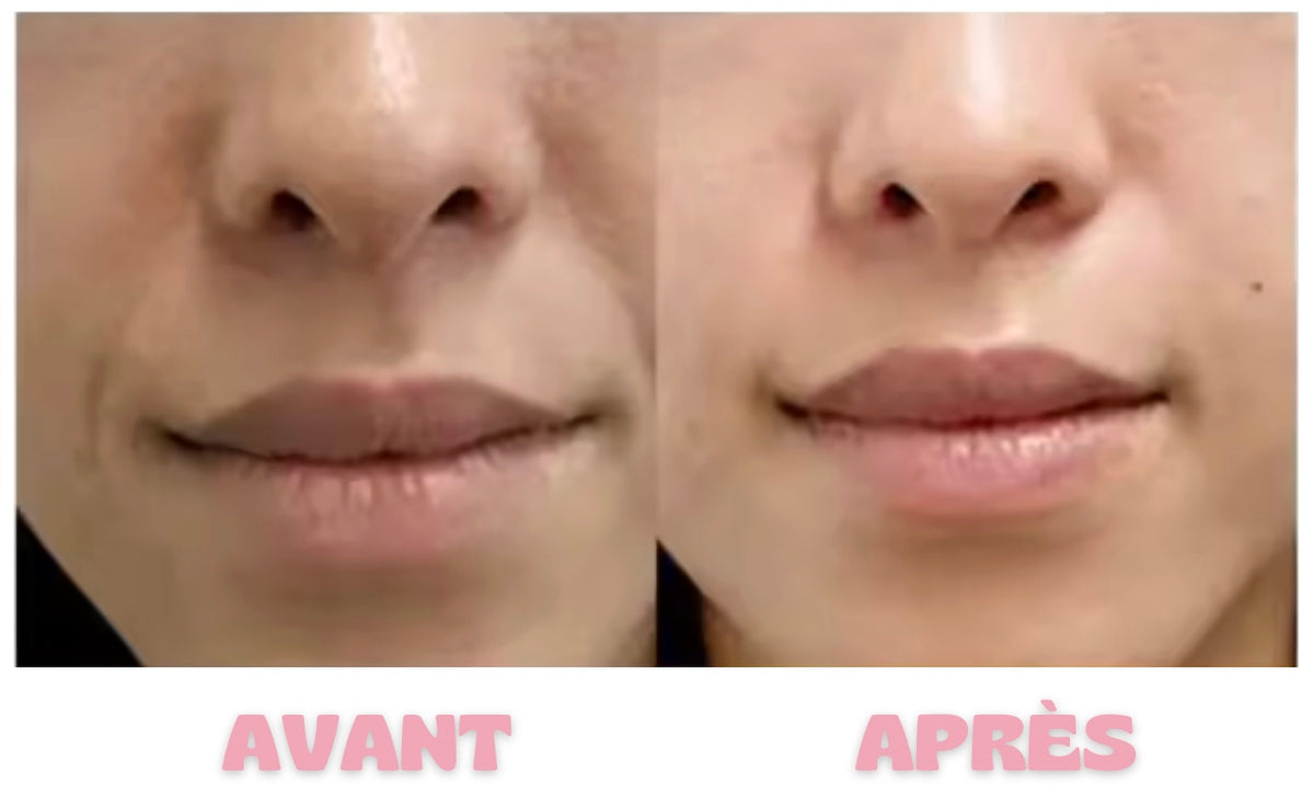 AMPOULE Collagène Profond