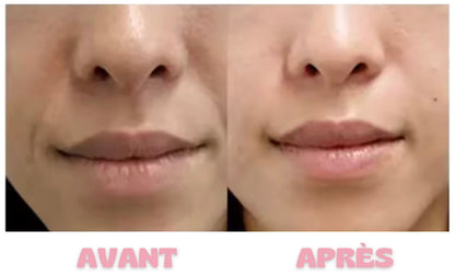 AMPOULE Collagène Profond
